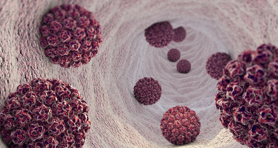 Mengenali Gejala Awal Infeksi Parasite yang Berpotensi Menyebabkan Papiloma